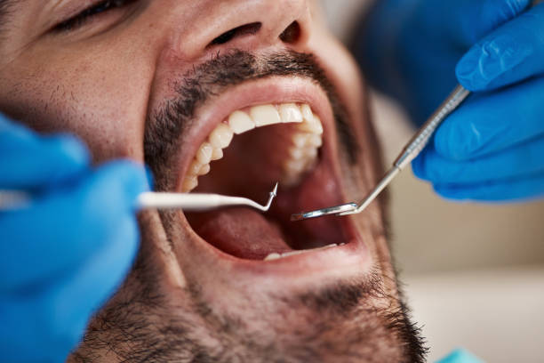 Best Emergency Root Canal Therapy in Bogata, TX
